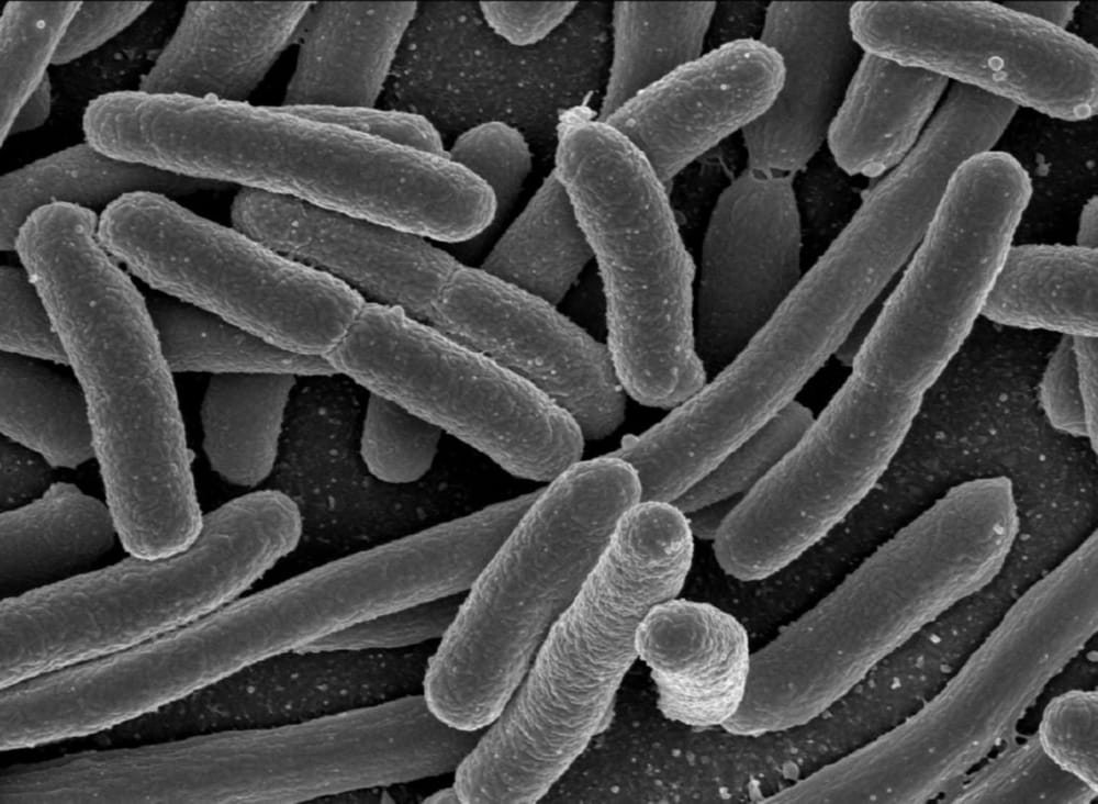 Tikros bakterijos po mikroskopu